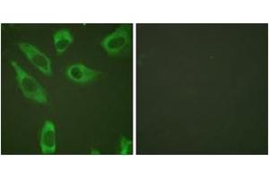 Immunofluorescence analysis of HeLa cells, using S6 Ribosomal Protein (Phospho-Ser240) Antibody. (RPS6 antibody  (pSer240))