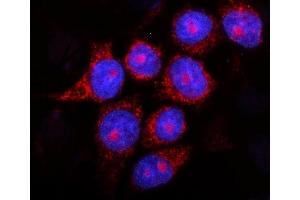IF analysis of Presenilin 2/AD5/PSEN2 using anti-Presenilin 2/AD5/PSEN2 antibody (ABIN7602796). (Presenilin 2 antibody  (C-Term))