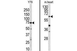 (LEFT) Western blot analysis of GGTLA1 antibody (N-term) in Y79 cell line lysates (35 µg/lane). (GGT5 antibody  (N-Term))