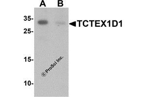 Western Blotting (WB) image for anti-Tctex1 Domain Containing 1 (TCTEX1D1) (N-Term) antibody (ABIN1587947) (TCTEX1D1 antibody  (N-Term))
