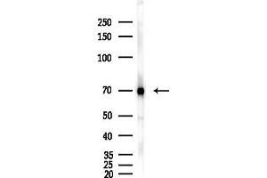 anti-Cytochrome C Oxidase Subunit I (COX1) (C-Term) antibody