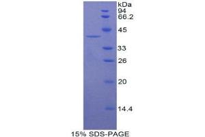 SDS-PAGE (SDS) image for Keratin 16 (KRT16) (AA 117-419) protein (His tag) (ABIN1080128) (KRT16 Protein (AA 117-419) (His tag))