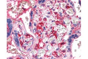 Anti-PF4 antibody IHC of human placenta. (PF4 antibody)