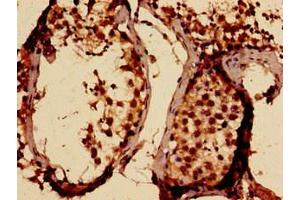 Immunohistochemistry analysis of human testis tissue using ABIN7169803 at dilution of 1:100 (SLITRK5 antibody  (AA 617-890))