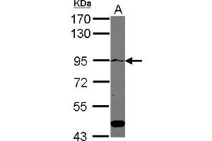 Image no. 1 for anti-ATPase, Ca++ Transporting, Type 2C, Member 1 (ATP2C1) (Internal Region) antibody (ABIN1495992)