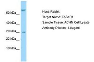 anti-Taste Receptor, Type 1, Member 1 (TAS1R1) (AA 327-376) antibody