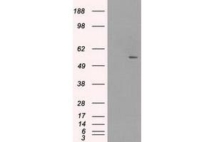 Image no. 1 for anti-Solute Carrier Family 2 (Facilitated Glucose/fructose Transporter), Member 5 (SLC2A5) antibody (ABIN1498474) (SLC2A5 antibody)