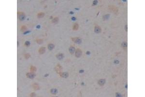 Figure. (RALBP1 antibody  (AA 381-470))