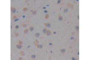 Figure. (RALBP1 antibody  (AA 381-470))
