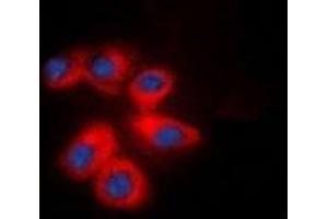 Immunofluorescence (IF) image for anti-Integrin beta 1 (ITGB1) (C-Term) antibody (ABIN7303982)