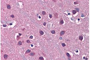 Human Brain, Cortex: Formalin-Fixed, Paraffin-Embedded (FFPE)