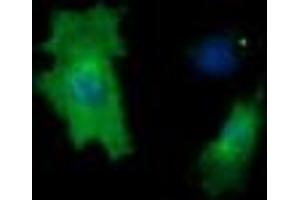Image no. 4 for anti-Cancer/testis Antigen 1B (CTAG1B) antibody (ABIN1499892) (CTAG1B antibody)