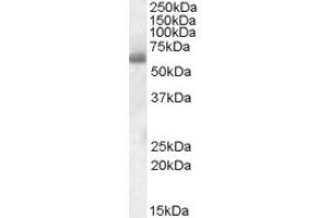 Image no. 1 for anti-SH2 Domain Containing 3A (SH2D3A) (Internal Region) antibody (ABIN375130)