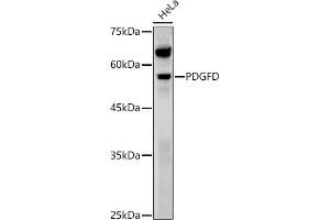 Western blot analysis of extracts of various cell lines, using PDGFD antibody (ABIN7269393) at 1:1000 dilution. (PDGFD antibody  (AA 185-364))