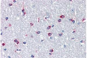 Image no. 1 for anti-Pituitary Homeobox 3 (PITX3) (N-Term) antibody (ABIN1495362) (PITX3 antibody  (N-Term))