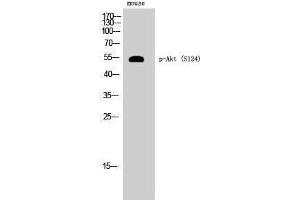 Western Blotting (WB) image for anti-V-Akt Murine Thymoma Viral Oncogene Homolog 1 (AKT1) (pSer124) antibody (ABIN3182507) (AKT1 antibody  (pSer124))
