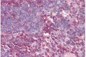 Image no. 2 for anti-Lamin B Receptor (LBR) (AA 503-552) antibody (ABIN6749731) (Lamin B Receptor antibody  (AA 503-552))