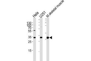Western Blotting (WB) image for anti-Polymerase (RNA) II (DNA Directed) Polypeptide C, 33kDa (POLR2C) antibody (ABIN5025249) (POLR2C antibody)
