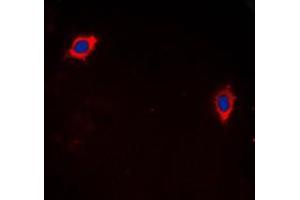 Immunofluorescent analysis of GHRH Receptor staining in LOVO cells. (GHRHR antibody  (C-Term))
