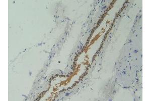 DAB staining on IHC-P; Samples: Mouse Skeletal muscle Tissue (Corin antibody  (AA 334-477))