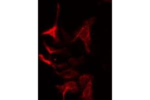 ABIN6275023 staining Hela cells by IF/ICC. (COPZ1 antibody  (N-Term))