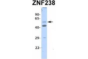 Host:  Rabbit  Target Name:  ZNF238  Sample Type:  Human Fetal Pancreas  Antibody Dilution:  1. (ZNF238 antibody  (N-Term))