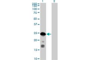 Western Blot analysis of CDKN1B expression in transfected 293T cell line by CDKN1B MaxPab polyclonal antibody.