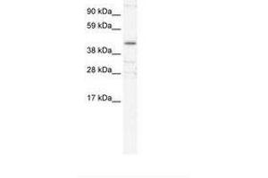 Image no. 2 for anti-YY1 Transcription Factor (YY1) (AA 274-323) antibody (ABIN6735976)