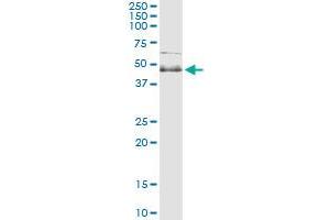 Immunoprecipitation of SPHK1 transfected lysate using anti-SPHK1 monoclonal antibody and Protein A Magnetic Bead , and immunoblotted with SPHK1 MaxPab rabbit polyclonal antibody. (SPHK1 antibody  (AA 1-384))
