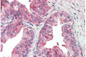 Human Prostate: Formalin-Fixed, Paraffin-Embedded (FFPE) (KIF6 antibody  (AA 177-190))