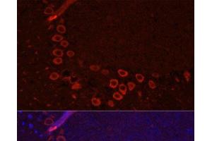Immunofluorescence analysis of Mouse brain using SLC1A1 Polyclonal Antibody at dilution of 1:100. (SLC1A1 antibody)