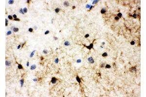 Anti-HSF2 antibody, IHC(P) IHC(P): Rat Brain Tissue (HSF2 antibody  (Middle Region))
