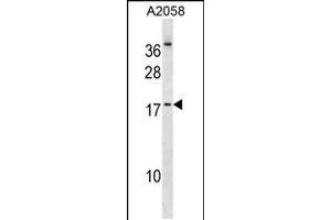 Western blot analysis in A2058 cell line lysates (35ug/lane). (NHLH2 antibody  (AA 63-91))