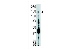 Antibody is used in Western blot to detect USP7 in T-47D cell lysate. (USP7 antibody  (C-Term))