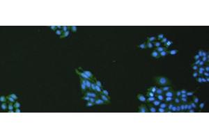 Immunofluorescence analysis of hepG2 cell using VNN1 Polyclonal Antibody at dilution of 1:100