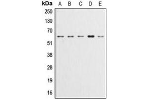 Western blot analysis of AKT (pY315) expression in HeLa (A), A549 (B), LOVO (C), HepG2 (D), NIH3T3 (E) whole cell lysates.