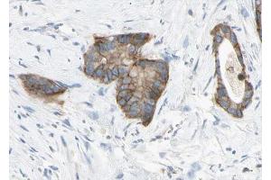 ABIN6268761 at 1/100 staining human liver tissue sections by IHC-P. (Claudin 6 antibody  (Internal Region))