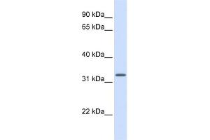 WB Suggested Anti-MRPS15 Antibody Titration: 0. (MRPS15 antibody  (Middle Region))