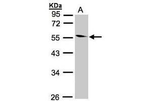 WB Image Sample(30 ug whole cell lysate) A:293T 10% SDS PAGE antibody diluted at 1:1000 (CORO1B antibody)