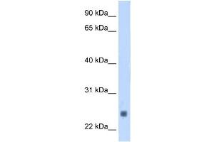 Troponin I Type 2 antibody used at 1. (TNNI2 antibody)