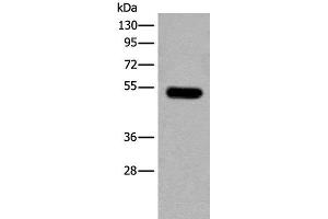 Western blot analysis of Mouse brain tissue lysate using CDKL2 Polyclonal Antibody at dilution of 1:250