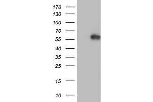 HEK293T cells were transfected with the pCMV6-ENTRY control (Left lane) or pCMV6-ENTRY AKT1 (Right lane) cDNA for 48 hrs and lysed. (AKT1 antibody)