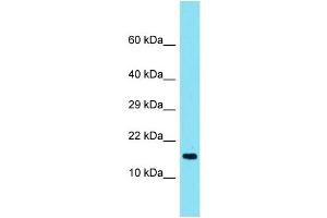 Host: Rabbit Target Name: TMEM190 Sample Type: Fetal Heart lysates Antibody Dilution: 1.