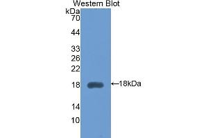 Detection of Recombinant HEXb, Mouse using Polyclonal Antibody to Hexosaminidase B Beta (HEXb)