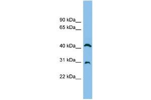 WB Suggested Anti-ADA Antibody Titration: 0. (ADA antibody  (N-Term))