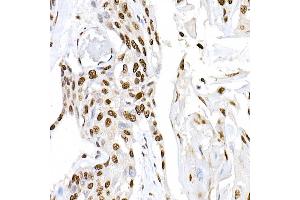 Immunohistochemistry (IHC) image for anti-Peroxisome Proliferator-Activated Receptor gamma (PPARG) (AA 50-150) antibody (ABIN3020844)