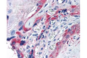 Anti-TGM2 / Transglutaminase 2 antibody IHC of human placenta.