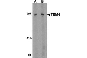 Western blot analysis of TEM4 in Jurkat Cell lysate with this product at (A) 1 and (B) 2 μg/ml. (ARHGEF17 antibody  (Center))