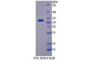 SDS-PAGE (SDS) image for Protein tyrosine Phosphatase, Receptor Type, N Polypeptide 2 (PTPRN2) (AA 782-1001) protein (His tag) (ABIN6239397) (PTPRN2 Protein (AA 782-1001) (His tag))