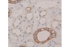 IHC-P analysis of Human Tissue, with DAB staining. (AP2M1 antibody  (AA 170-435))